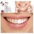CarvoX - clareador dental 100% natural